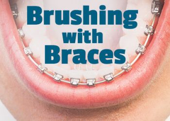 Bellevue dentists, Dr. Mack & Dr. Wachter of Family Dentistry of Bellevue inform patients about the best tools and tricks to use when performing oral hygiene routines with braces.