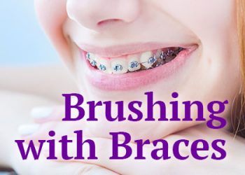 Bellevue dentists, Dr. Mack & Dr. Wachter of Family Dentistry of Bellevue informs patients about the best tools and tricks to use when performing oral hygiene routines with braces.