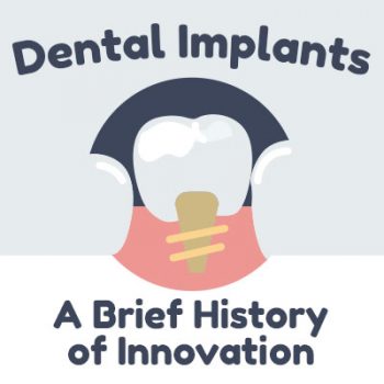 Dental implants: a brief history of innovation