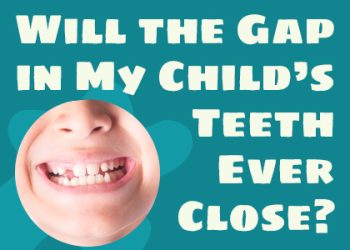 Bellevue dentists Dr. Mack & Dr. Wachter of Family Dentistry of Bellevue talk about potential causes and treatments for gapped teeth in children.