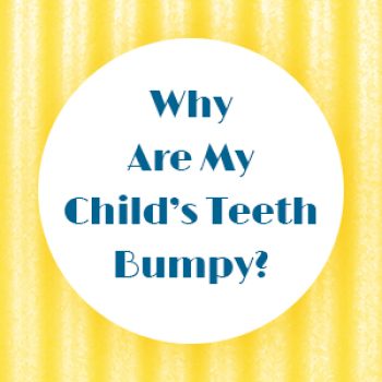 Bellevue dentists, Drs. Mack and Wachter at Family Dentistry of Bellevue tell parents about bumpy tooth ridges called mamelons and why they’re no cause for concern.