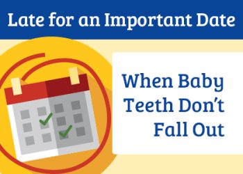 Bellevue dentists, Dr. Mack & Dr. Wachter of Family Dentistry of Bellevue, discusses the causes and treatment options of over-retained baby teeth that don’t come out naturally on their own.