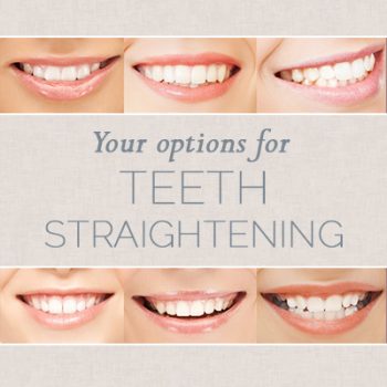 Bellevue dentists, Dr. Mack & Dr. Wachter of Family Dentistry of Bellevue, share all you need to know about choosing the right teeth straightening option for you.