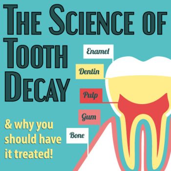 Bellevue dentists, Dr. Mack & Dr. Wachter of Family Dentistry of Bellevue, discuss the science of tooth decay: what it is and what you can do to prevent it.